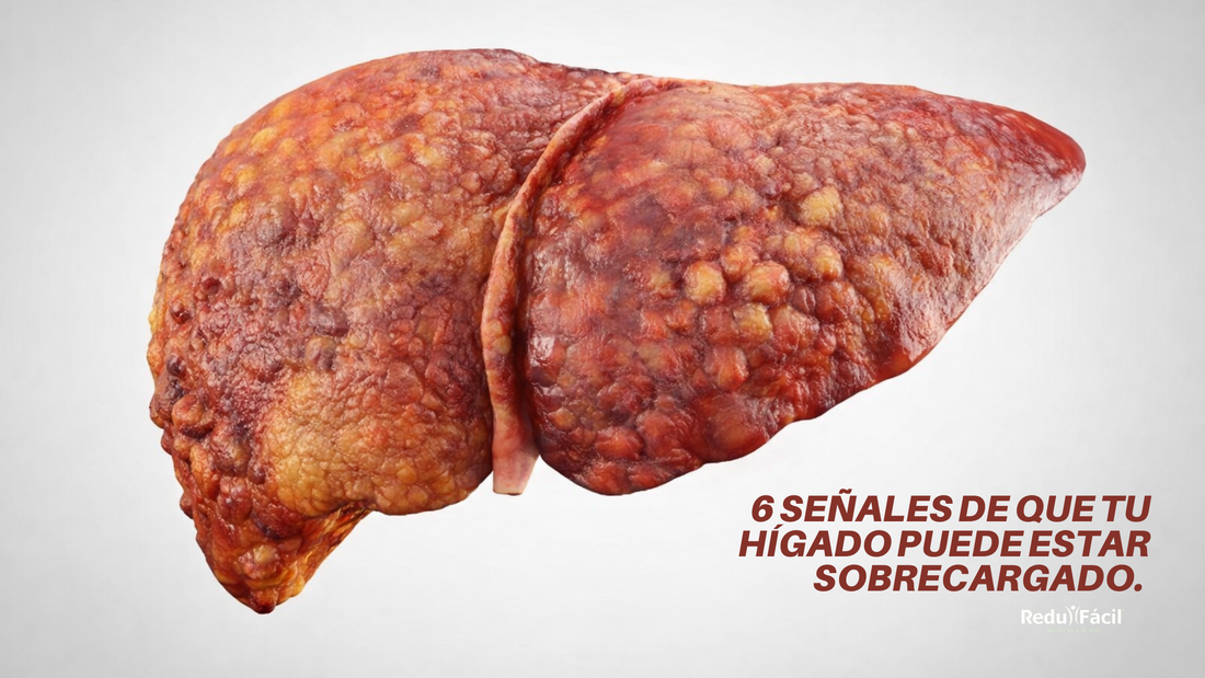 6 Señales de que tu hígado puede estar sobrecargado.
