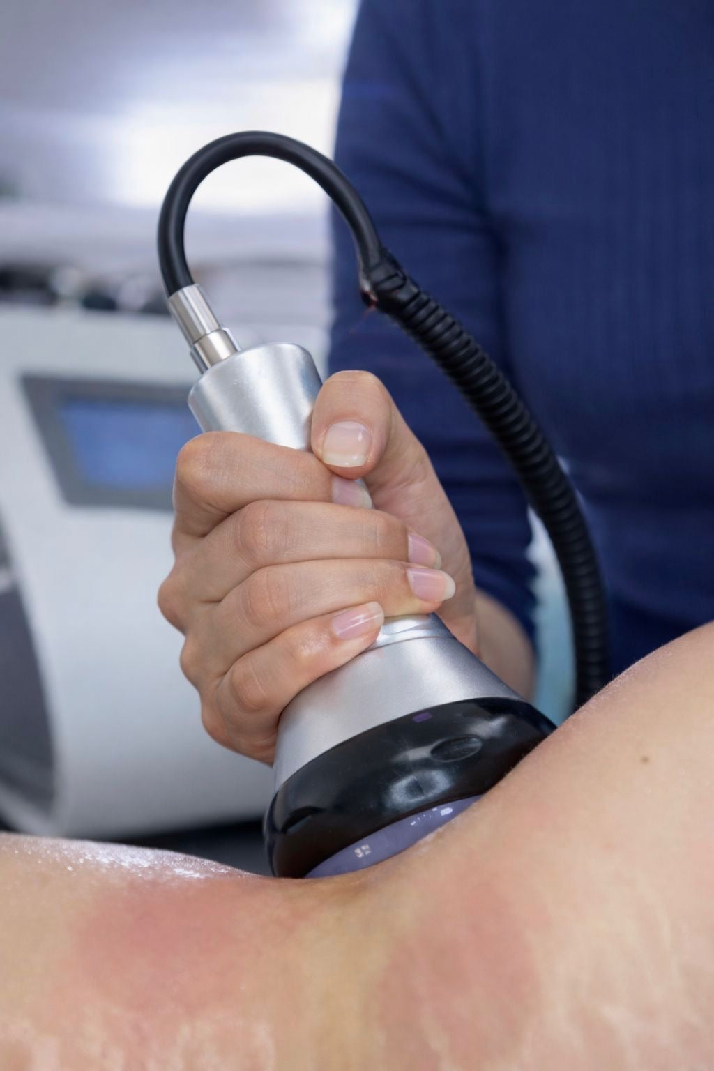 Moldeado de Figura – 10 sesiones