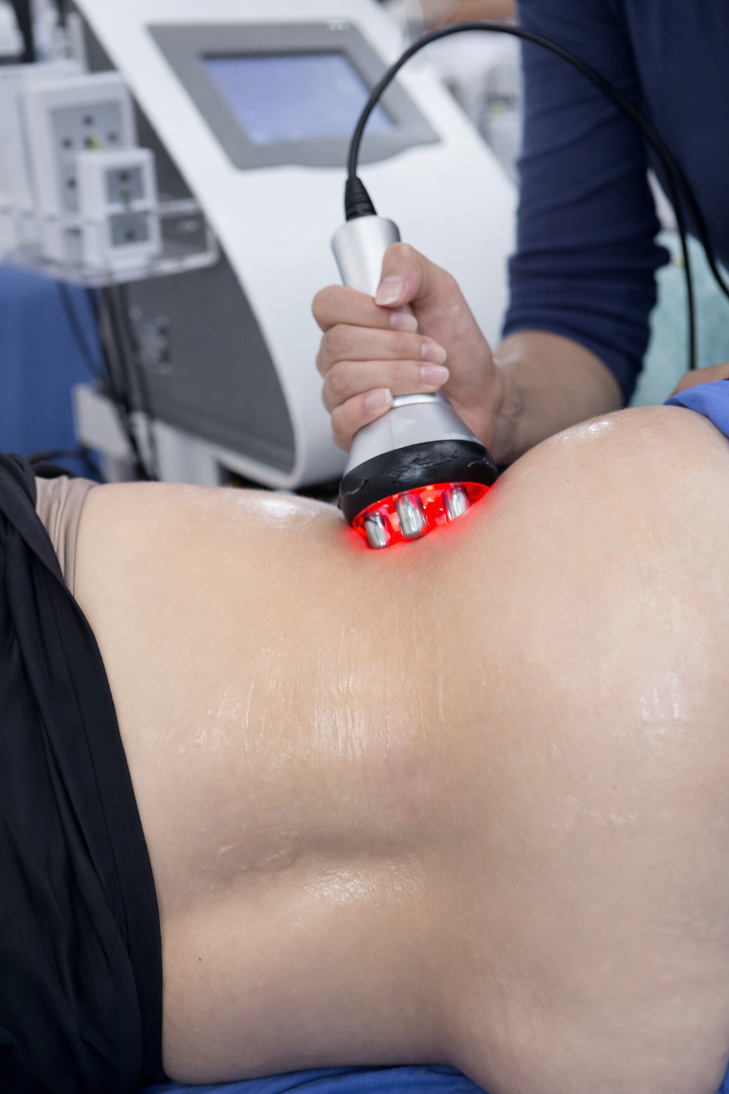 Moldeado de Figura – 10 sesiones