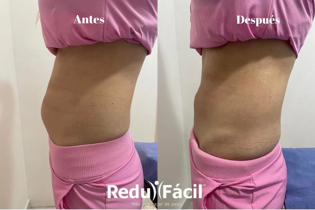 Paquete Nueva Imagen | Afina tu figura en 45 días
